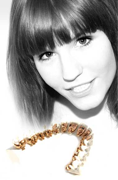 Lingual Braces