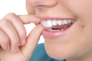 Park ridge invisalign orthodontist