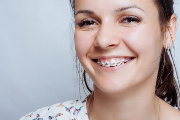 Braces in Elk Grove, Invisalign in Elk Grove, Orthodontist in Elk Grove