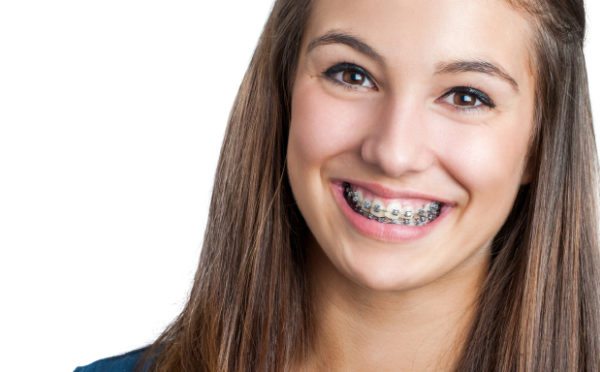 Orthodontist in Justice, Braces in Justice, Invisalign in Justice