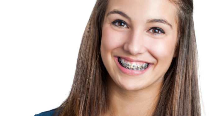 Orthodontist in Justice, Braces in Justice, Invisalign in Justice