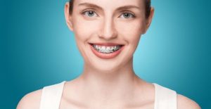 Braces in Burbank, Orthodontist in Burbank,