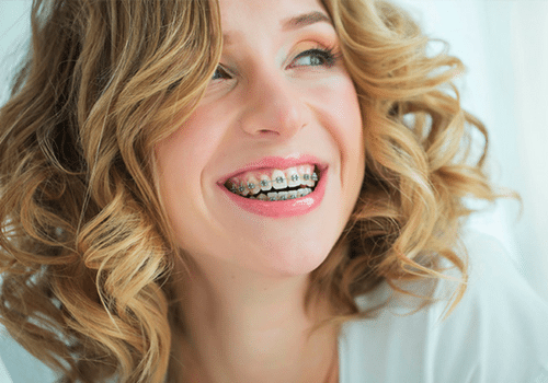 Orthodontist in Centennial, Braces in Centennial, Invisalign in Centennial, Dentist in Centennial