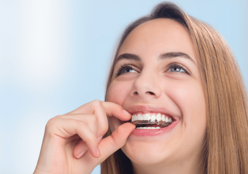 Invisalign Clear Aligners