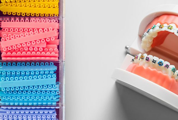 Braces Rubber Bands Colors