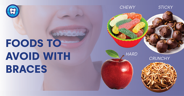 foods to avoid with braces