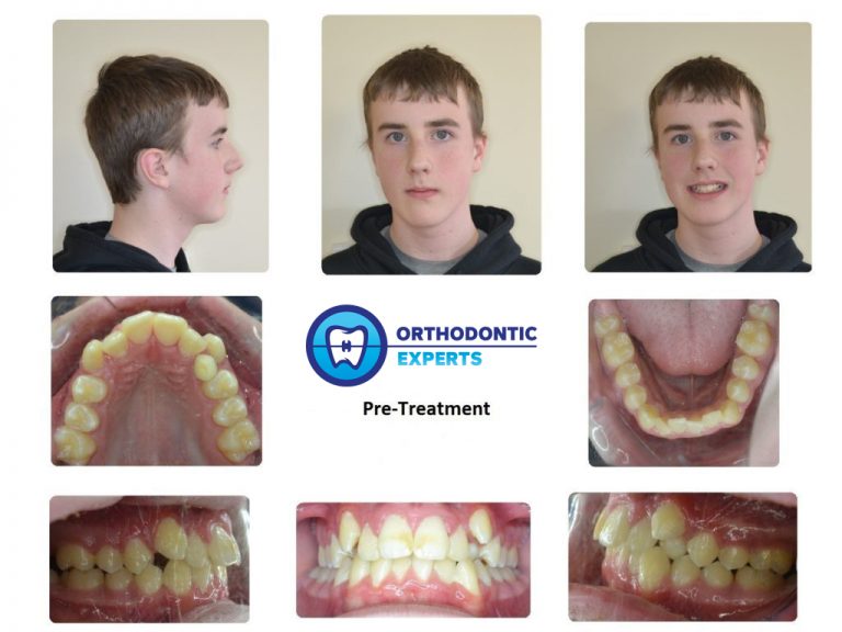 Orthodontic Experts of Burbank Orthodontist Braces & Invisalign