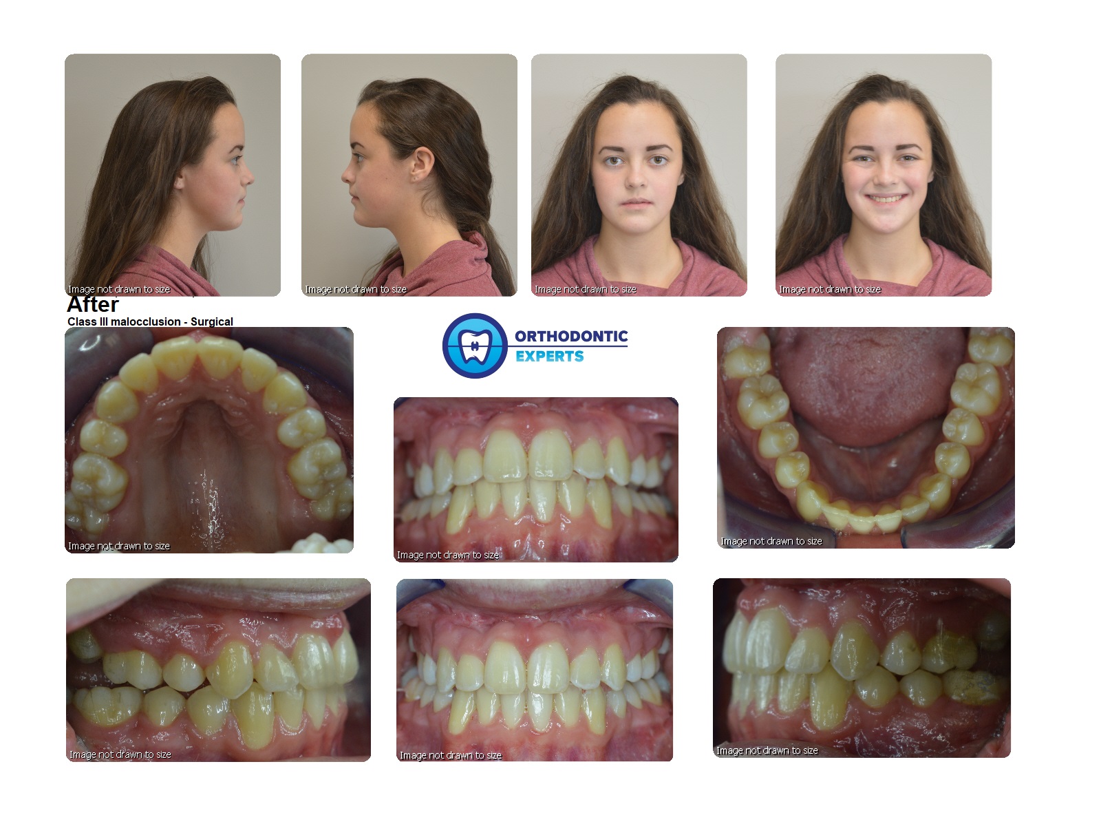 4Surgical Top Orthodontist Braces, Invisalign
