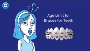 Age limit for braces for teeth Best Age for Braces Teeth