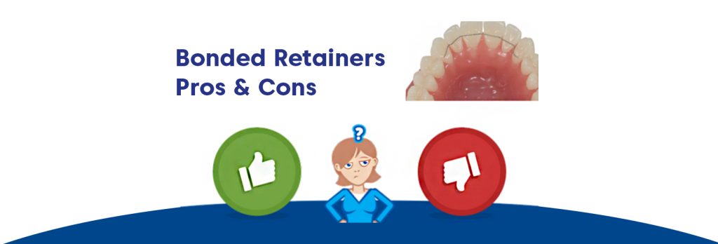 Bonded retainer pros and cons