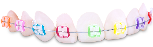 braces colors