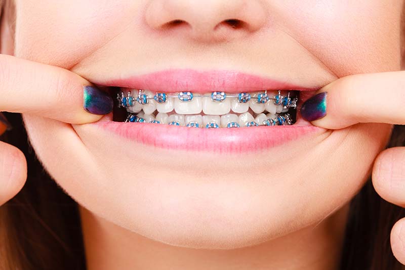wisconsin medicaid orthodontist rockford
