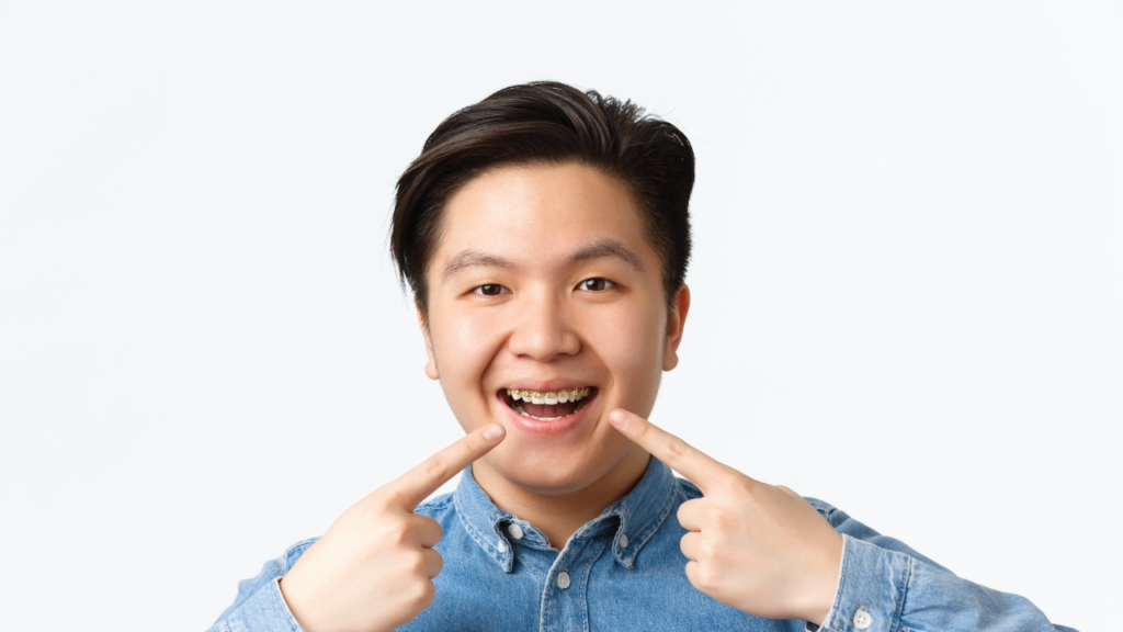 traditional braces