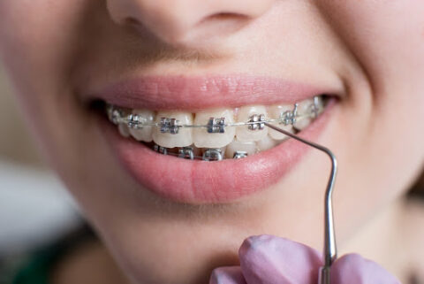 Oswego Orthodontist