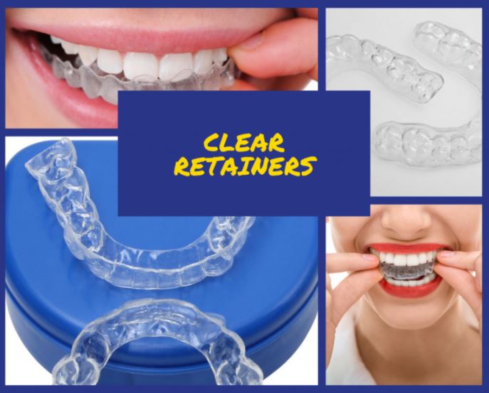 clear retainers