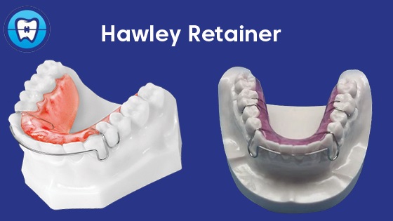 hawley retainer
