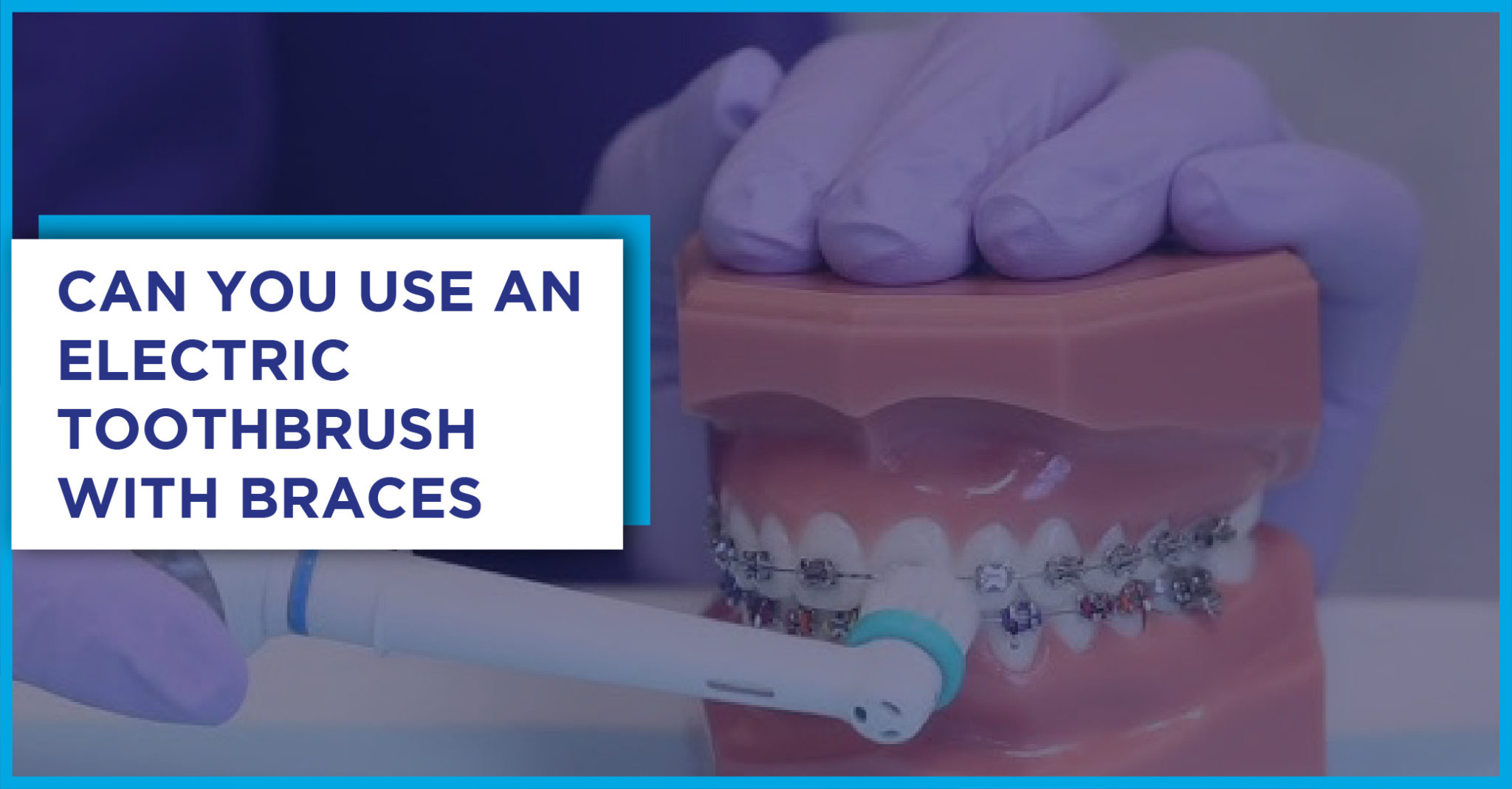 Can You Use an Electric Toothbrush with Braces? All You Need to Know!
