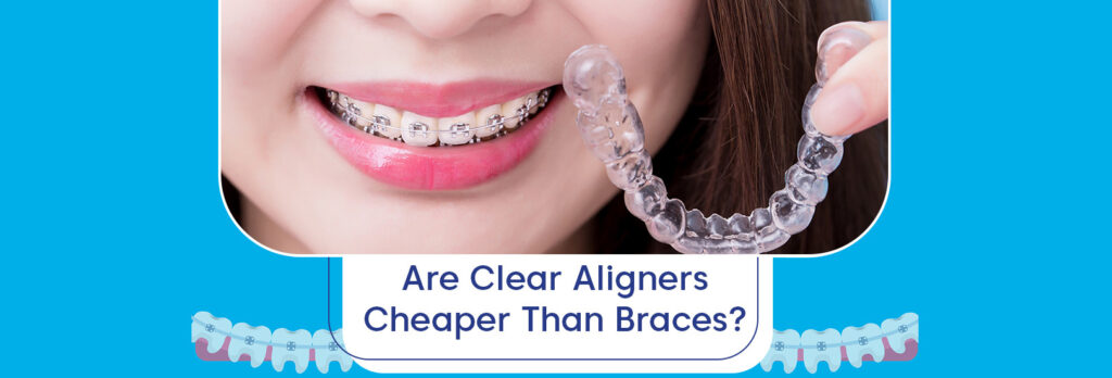 is invisalign cheaper than braces