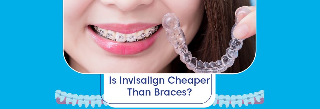 is invisalign cheaper than braces