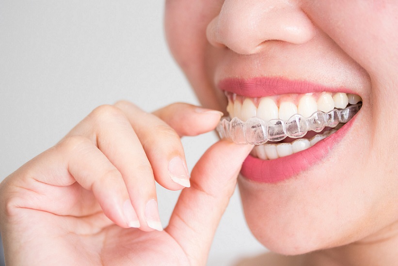 invisalign bloomingdale near glendale heights