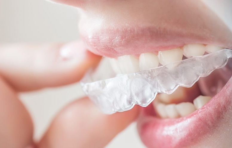 invisalign hanover park