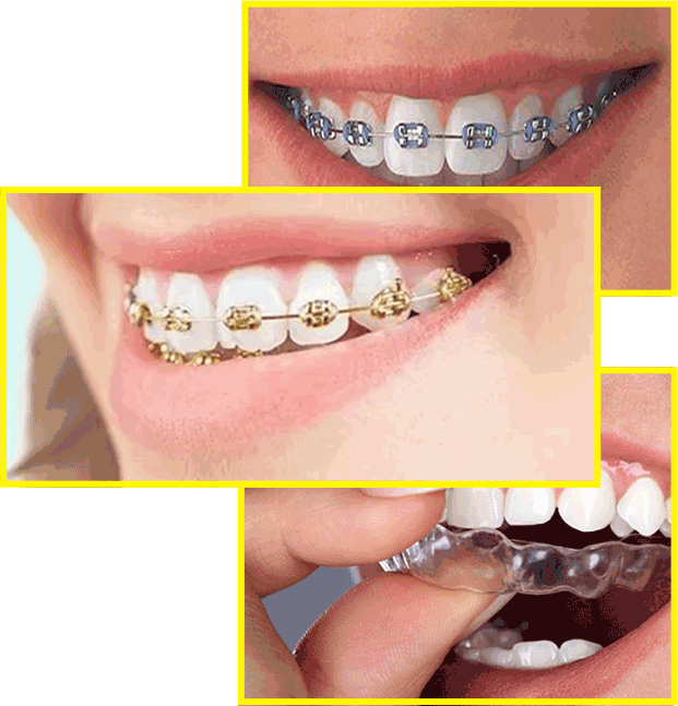 affordable orthodontic treatment