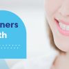 can retainers move teeth back