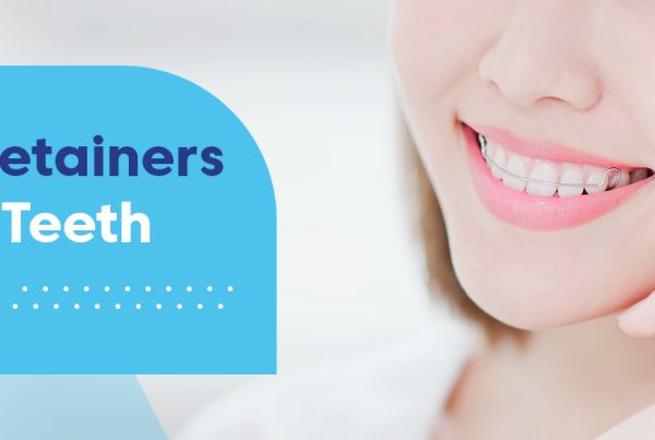 can retainers move teeth back