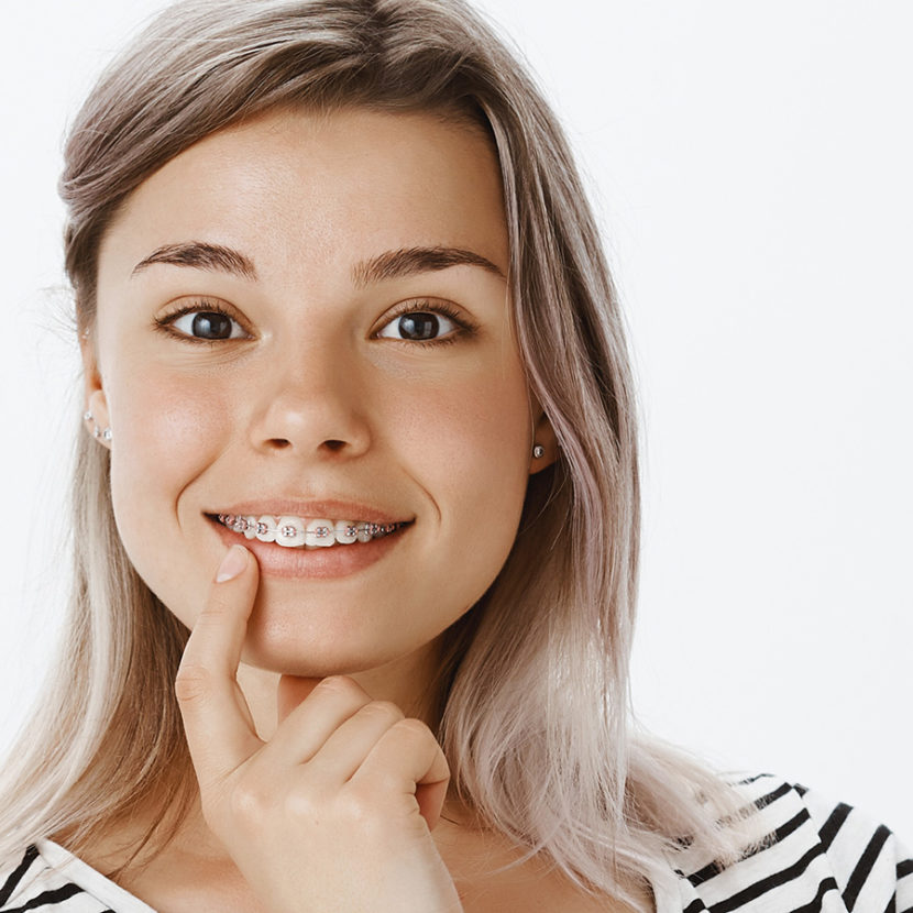 do braces change your face shape