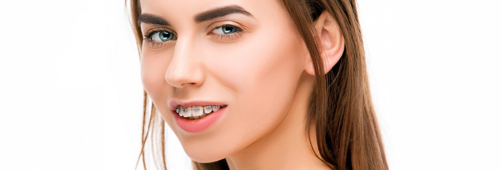 can clear aligners fix an overbite