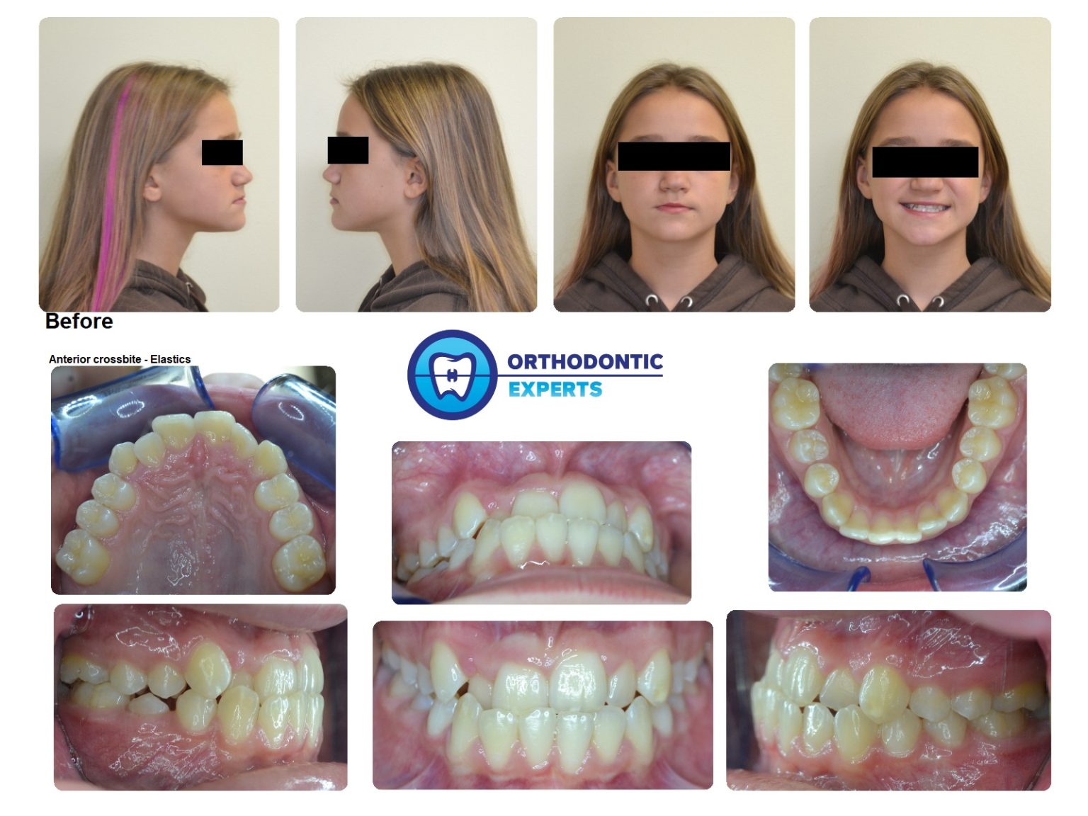Before & After Gallery Post and PreTreatment Results