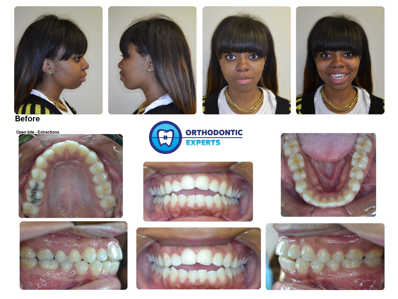 Before After Gallery Post and Pre Treatment Results