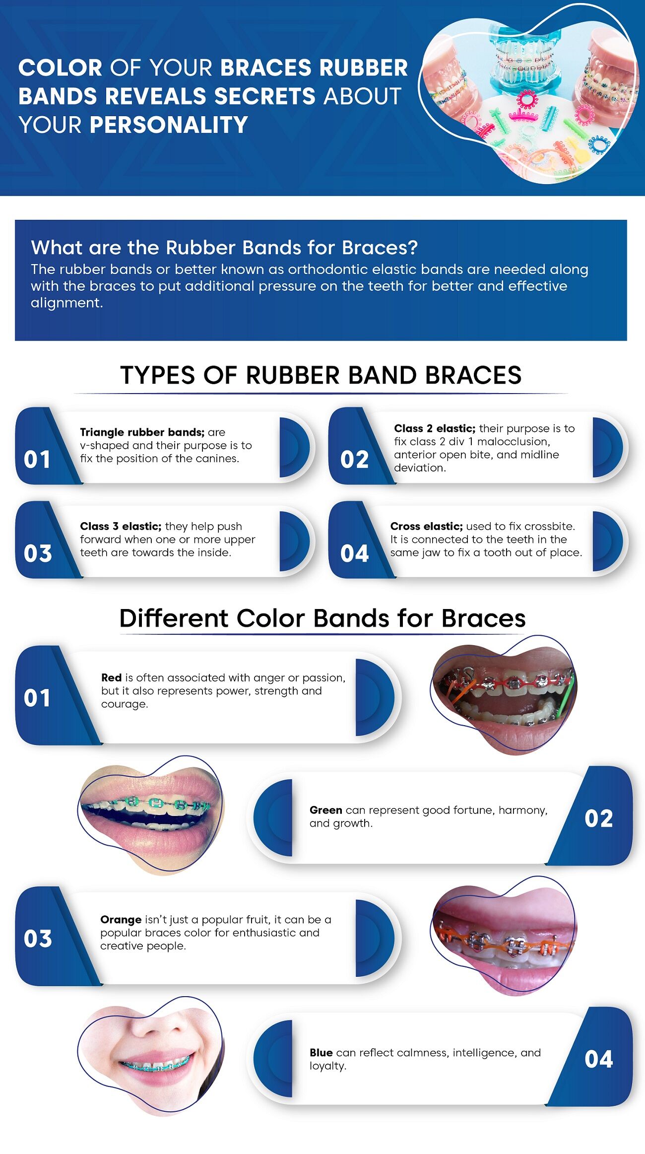 different braces bands