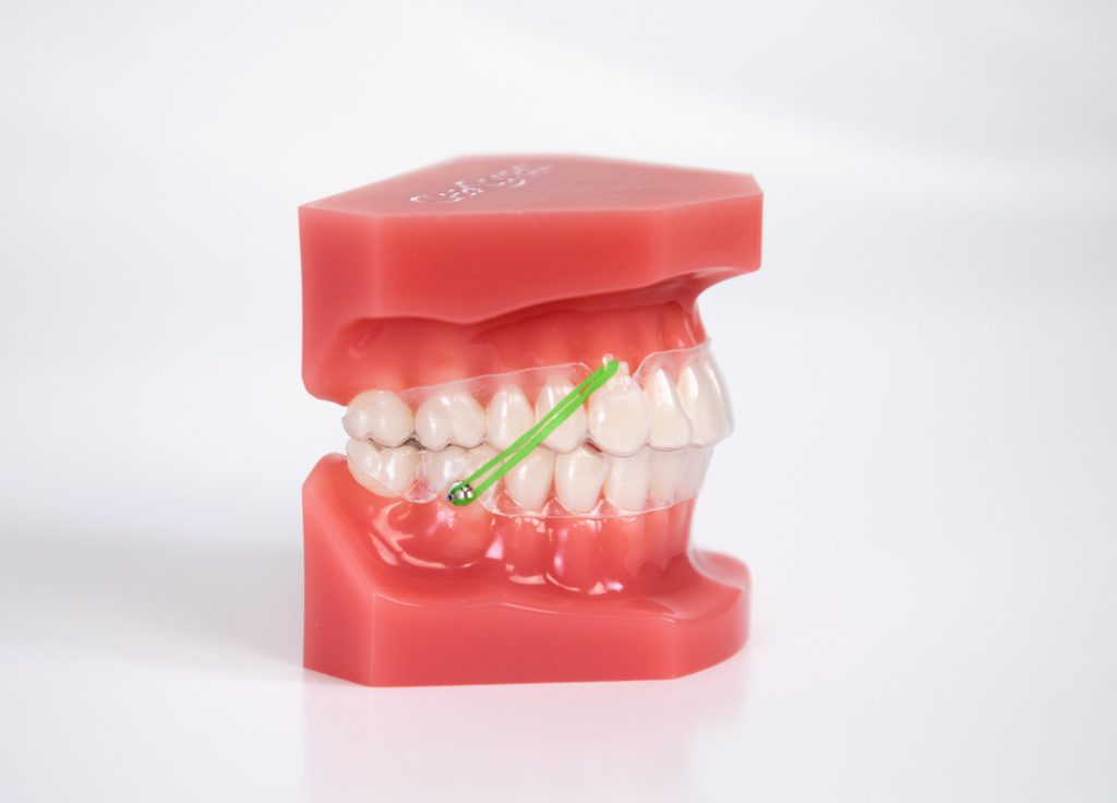 Braces Rubber Bands Colors
