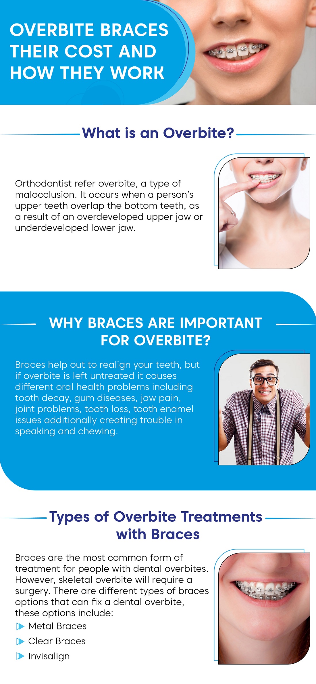 How Do BRACES FIX Overbites?, Overbite Before and After Braces