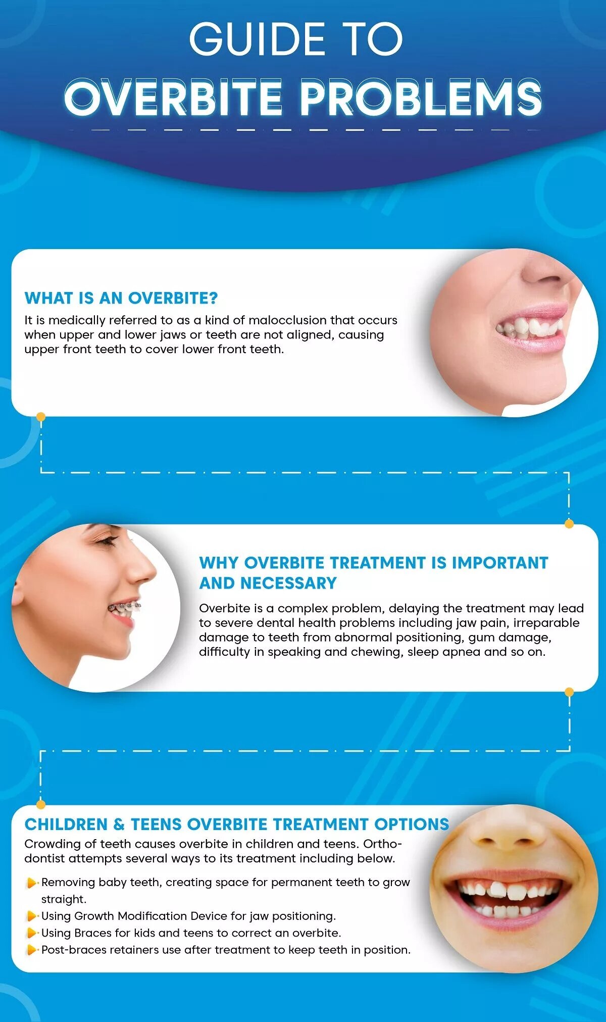 Overbite Treatment Options