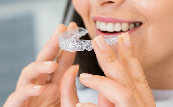 removable plastic aligners