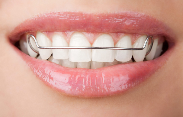 Orthodontic Retainer FAQs