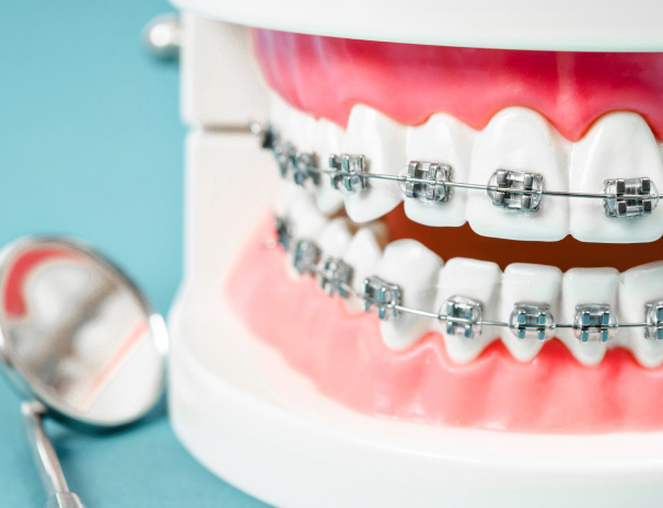 What to do when I have an orthodontic wire sticking out and poking the gums?