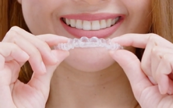 Clear Plastic Aligners