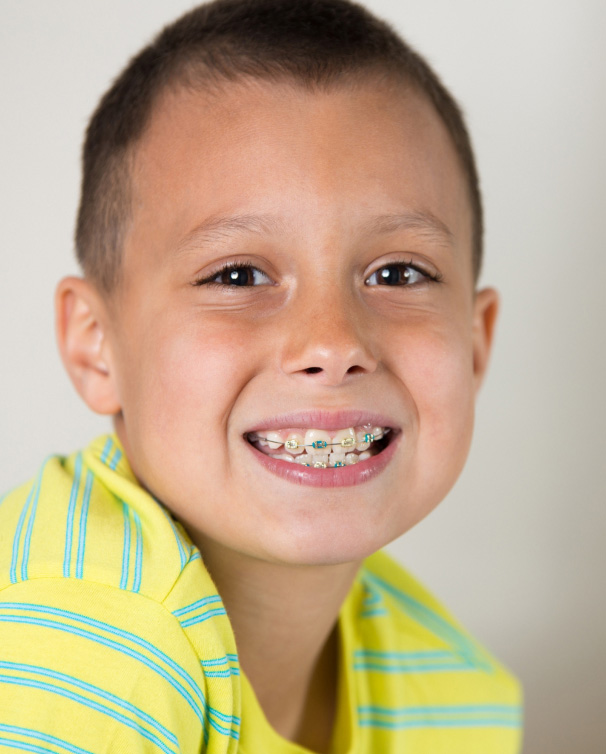 phase 1 vs phase 2 orthodontics cost