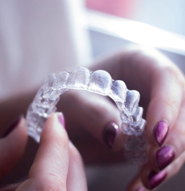 Vivera Retainers Benefits of Vivera Retainers & Cost