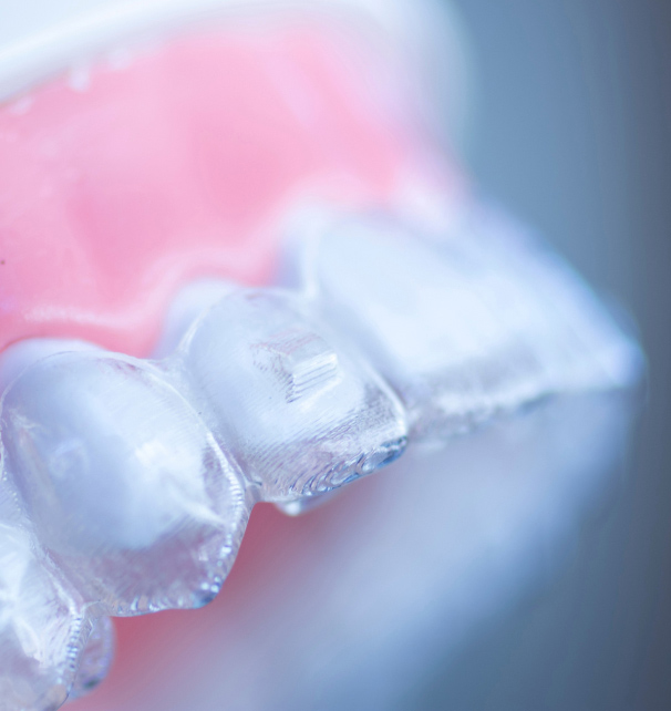advantages & cost of clear aligners