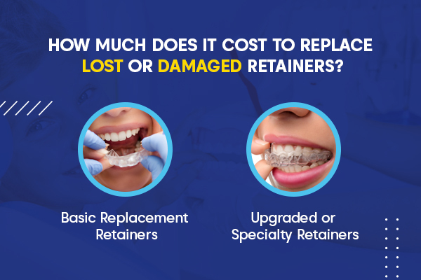 how much are retainers to replace