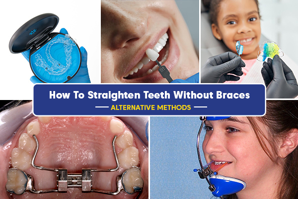 straighten teeth without braces