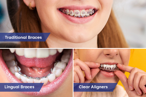 affordable orthodontic options