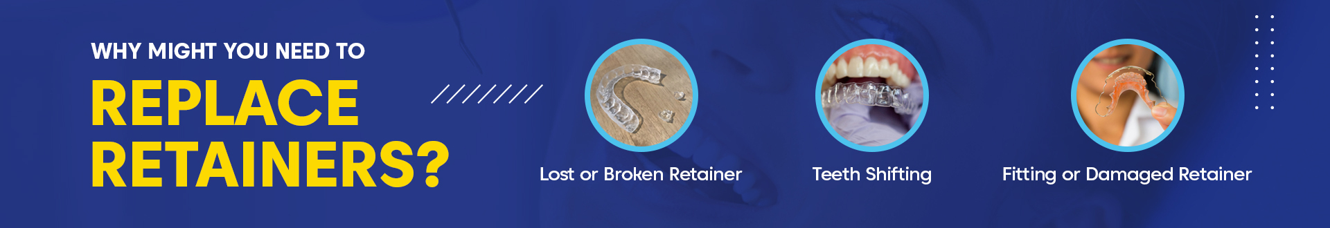 how can i get a new retainer