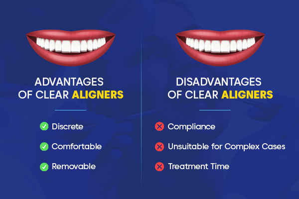 pros and cons of clear aligners