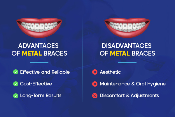 Advantages and Disadvantages of Metal Braces.