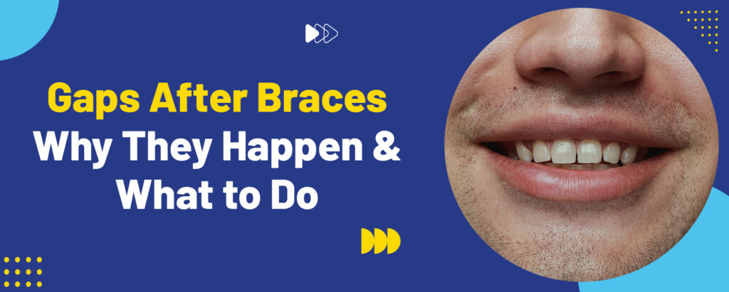 gap in teeth after braces